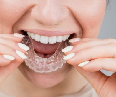 Close-up portrait of a woman putting on a transparent plastic retainer. A girl corrects a bite with the help of an orthodontic device