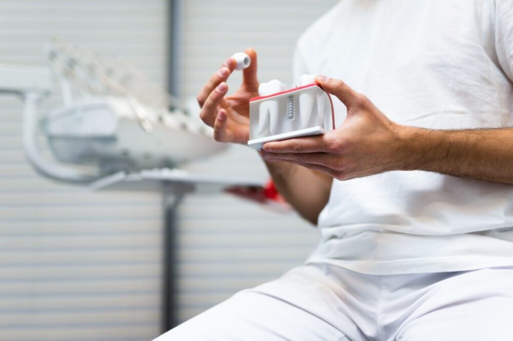 Dentist doctor holding teeth implant  model in his hands
