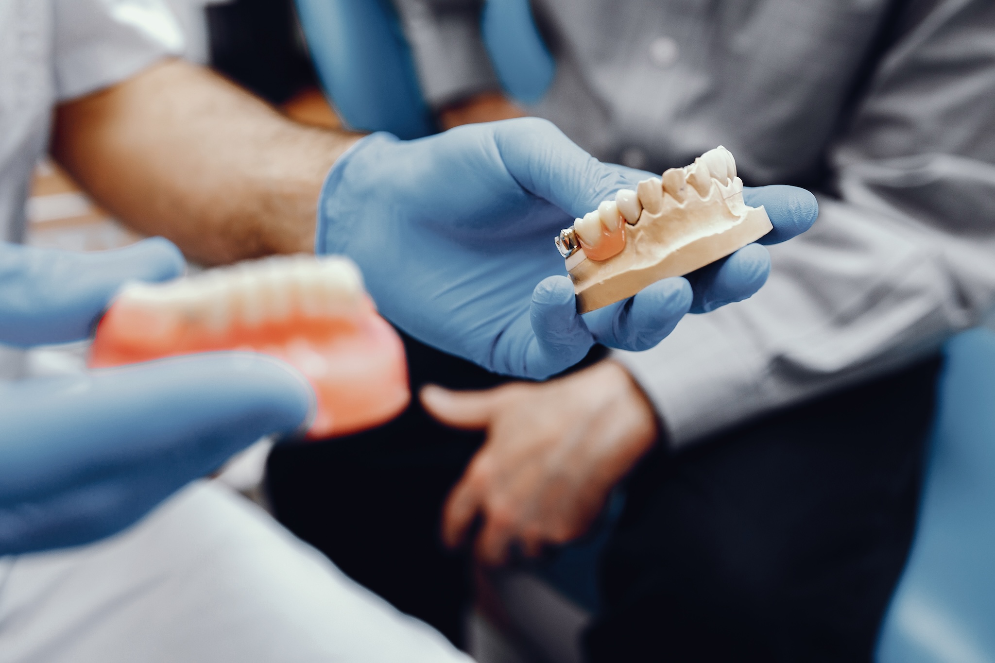 Implantologie-2-epanouident-christian-bitar--dentiste-amiens